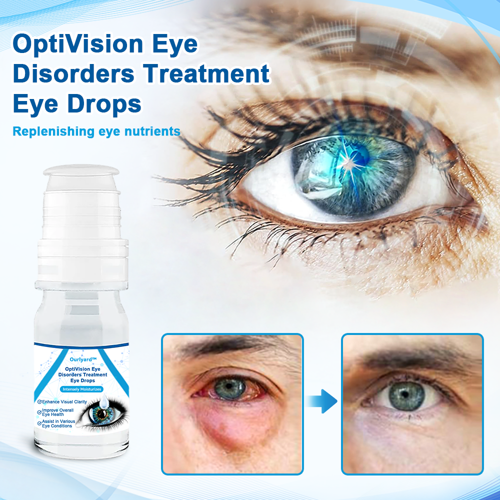 Eye Disorders Treatment Eye Drops – Wisely Walrus