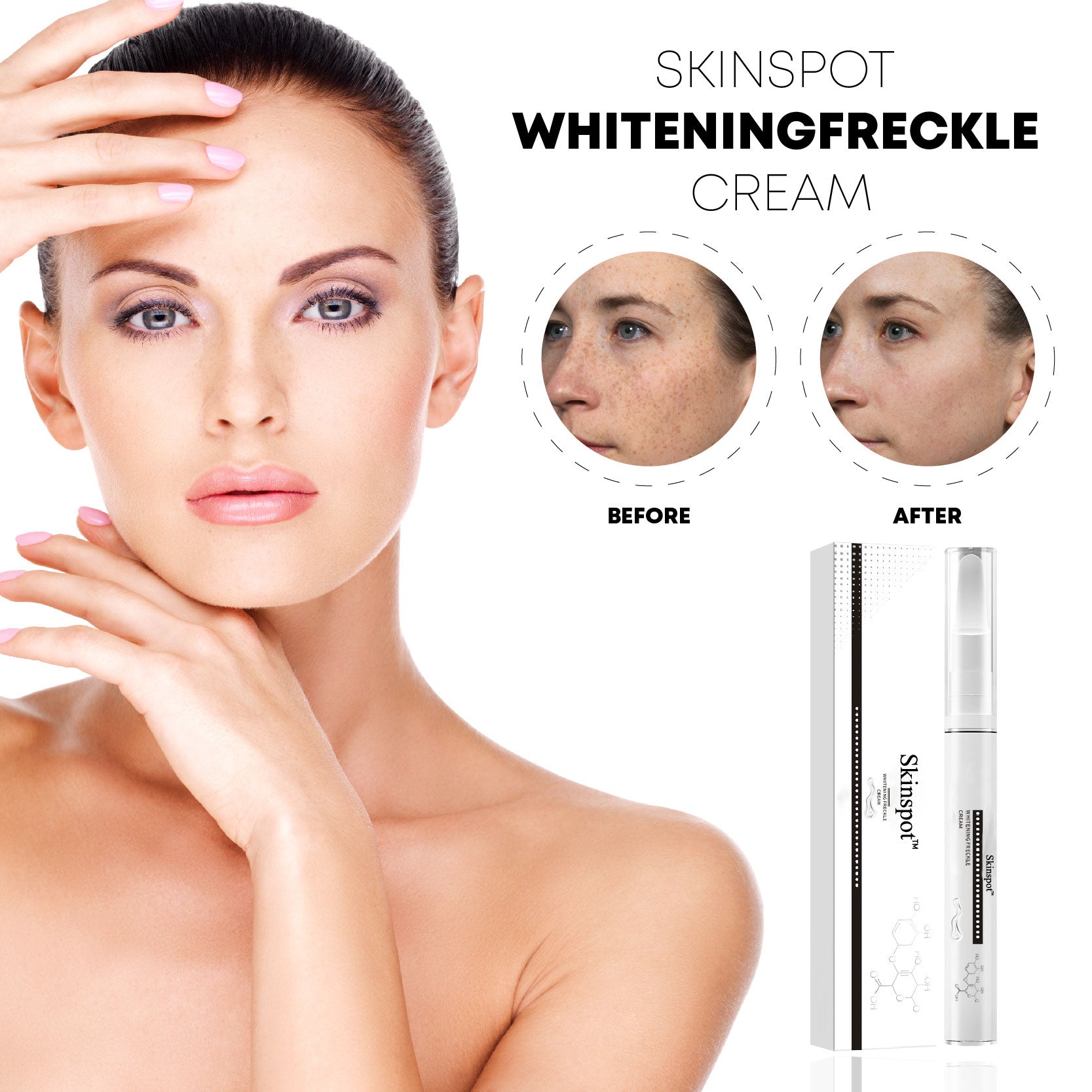 SkinSpot WhiteningFreckle Cream