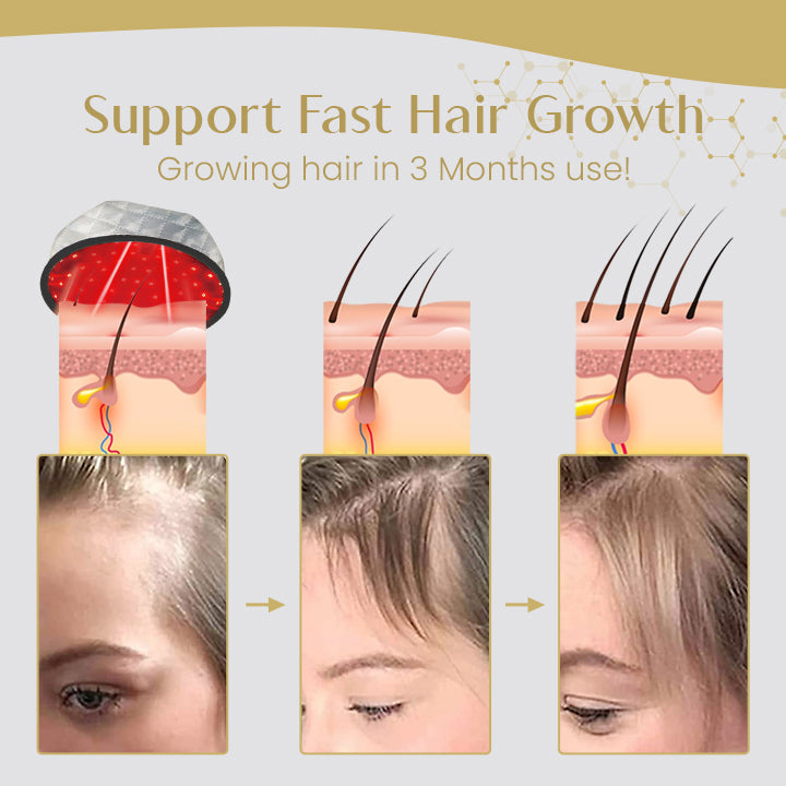 Laser Hair Growth Cap