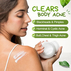 Bacne Treatment Cream